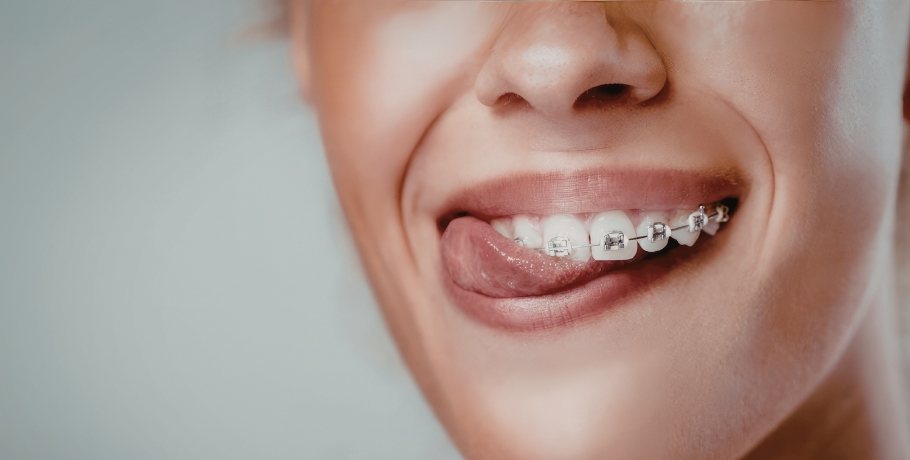 Herpes: objawy, zakaźność i co może pomóc zmniejszyć nawroty