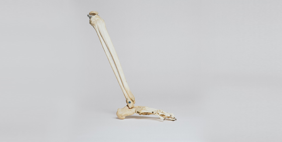 Wszystko, co musisz wiedzieć o wapniu Wszystko, co musisz wiedzieć o wapniu